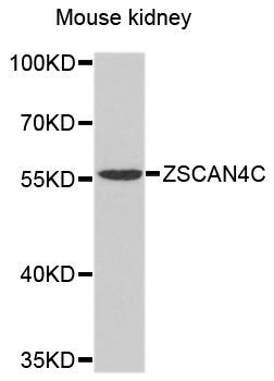 Western blot - ZSCAN4C Polyclonal Antibody (144-10205)