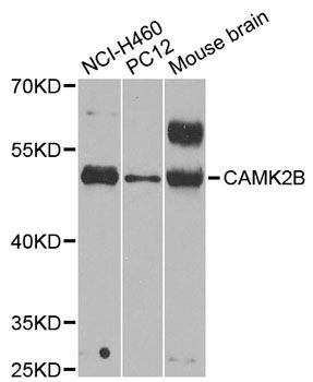 Western blot - CAMK2B antibody (144-02508)