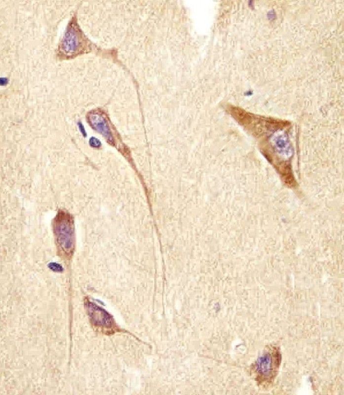 IHC-P