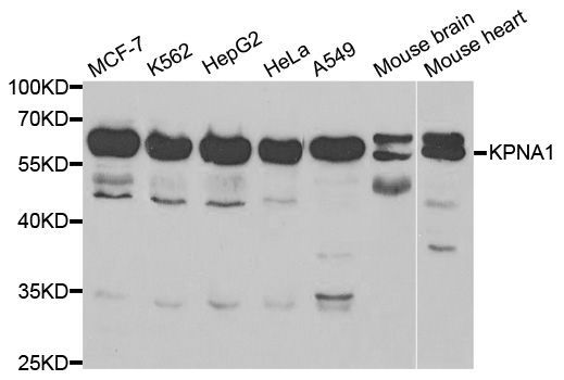 Western blot - KPNA1 antibody (144-60415)