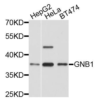 Western blot - GNB1 antibody (144-01867)