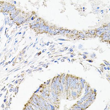 Immunohistochemistry - SDC2 antibody (144-01810)
