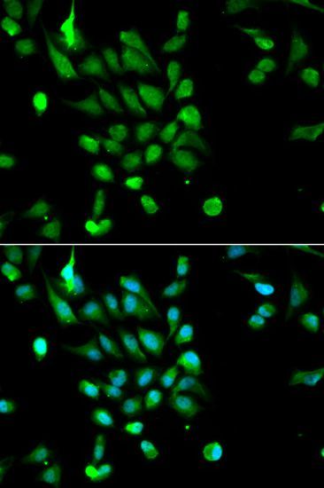 Immunofluorescence - PSMC5 antibody (144-01538)