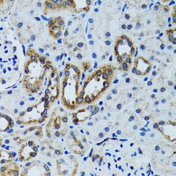 Immunohistochemistry - RPN1 antibody (144-600827)