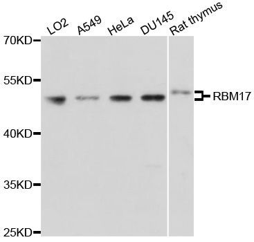 Western blot - RBM17 Polyclonal Antibody (144-03240)