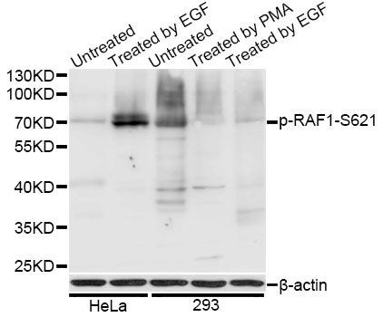 Western blot - Phospho-RAF1-S621 pAb (144-50087)