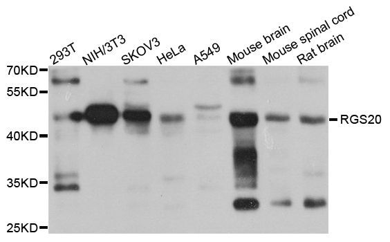 Western blot - RGS20 antibody (144-08167)