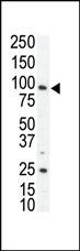 WB