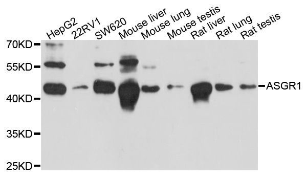 Western blot - ASGR1 antibody (144-60262)