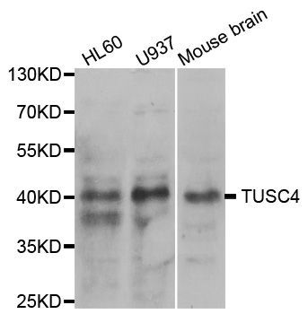 Western blot - NPRL2 antibody (144-05859)
