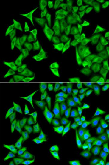 Immunofluorescence - PSMD9 antibody (144-05357)