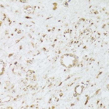 Immunohistochemistry - CIAPIN1 Polyclonal Antibody (144-06336)