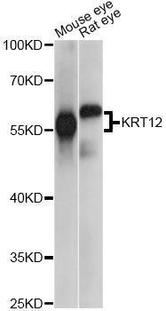 Western blot - KRT12 antibody (144-60772)