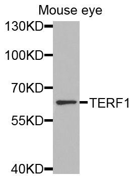 Western blot - TERF1 Polyclonal Antibody (144-60007)