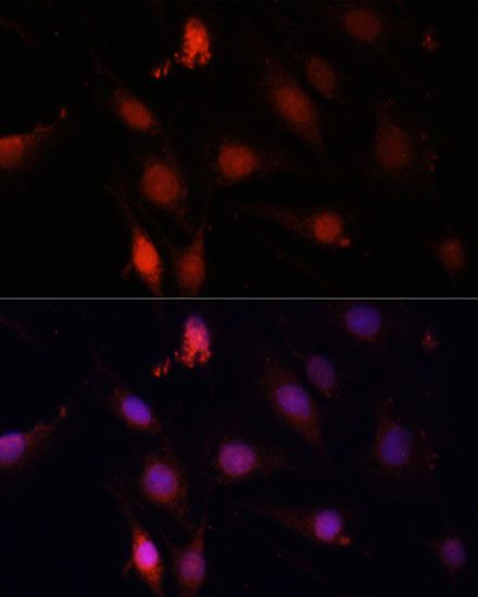 Western blot