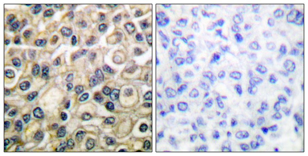 IHC