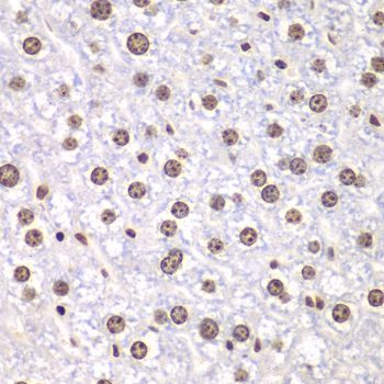 Immunohistochemistry - TOP1 Polyclonal Antibody (144-12524)