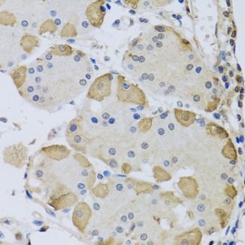 Immunohistochemistry - ANAPC10 antibody (144-08330)
