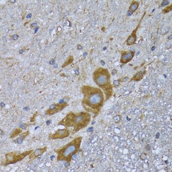 Immunohistochemistry - EIF2AK4 antibody (144-12618)