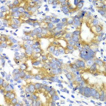 Immunohistochemistry - TFAM Polyclonal Antibody (144-013552)