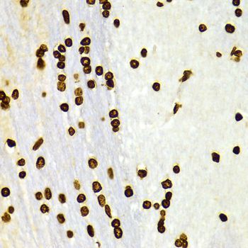 Immunohistochemistry - DiMethyl-Histone H3-K27 pAb (144-02362)