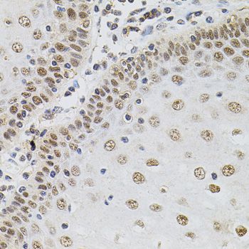 Immunohistochemistry - TGM2 Polyclonal Antibody (144-00981)