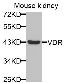 Western blot - VDR antibody (144-02194)
