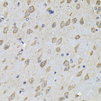 Immunohistochemistry - NFU1 Polyclonal Antibody (144-07097)