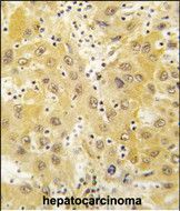 IHC-P