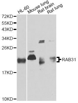 Western blot - RAB31 antibody (144-61369)