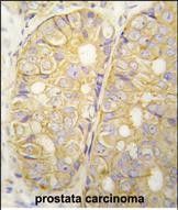 IHC-P