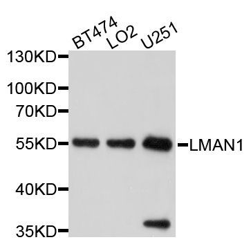 Western blot - LMAN1 Polyclonal Antibody (144-010440)