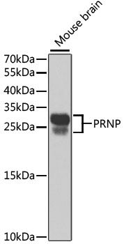 Western blot - PRNP antibody (144-02583)