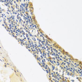 Immunohistochemistry - EDN1 Polyclonal Antibody (144-00686)