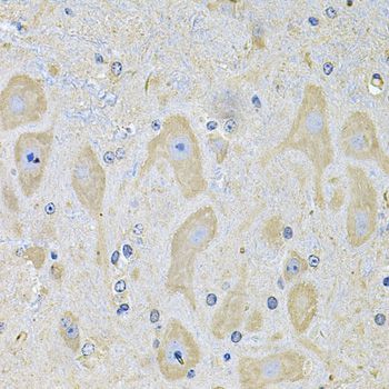Immunohistochemistry - EPHA2 Antibody (144-07183)