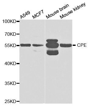 Western blot - CPE antibody (144-05458)