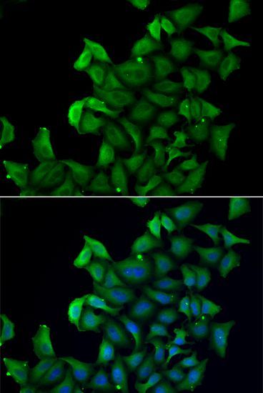 Immunofluorescence - FABP5 antibody (144-06373)