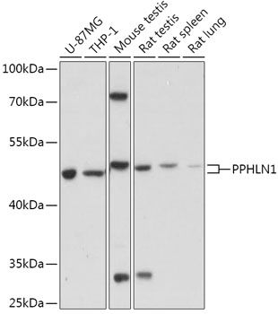 Western blot