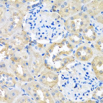 Immunohistochemistry - COTL1 antibody (144-04550)