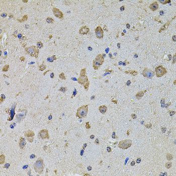 Immunohistochemistry - EIF4A2 Polyclonal Antibody (144-03849)