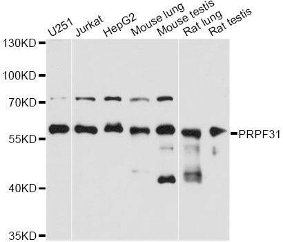 Western blot - PRPF31 Polyclonal Antibody (144-61424)