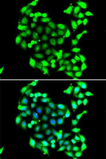 Immunofluorescence - GTF2H3 Polyclonal Antibody (144-07188)