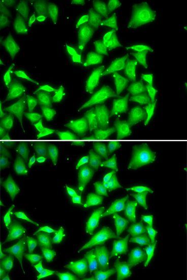 Immunofluorescence - PPM1A Polyclonal Antibody (144-06699)