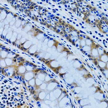 Immunohistochemistry - IMPA1 antibody (144-06381)