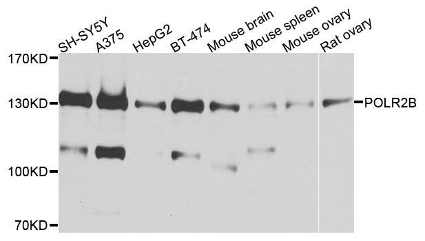 Western blot - POLR2B Polyclonal Antibody (144-05928)