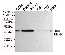 WB