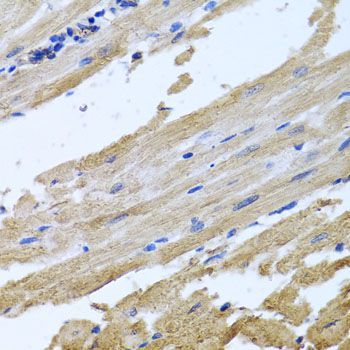 Immunohistochemistry - NSF Polyclonal Antibody (144-00926)