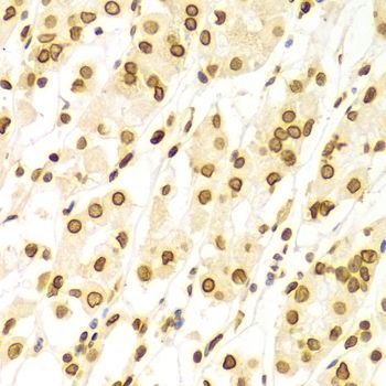 Immunohistochemistry - Lamin A/C Polyclonal Antibody (144-00249)