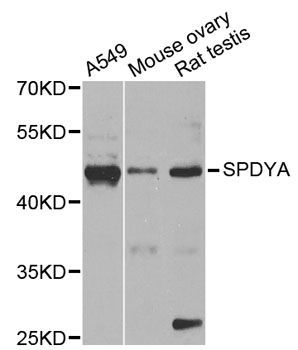 Western blot - SPDYA antibody (144-02153)