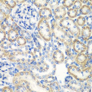 Immunohistochemistry - SMYD1 Polyclonal Antibody (144-02340)